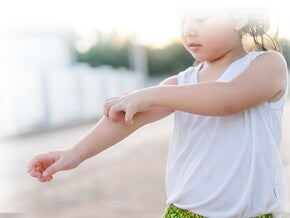 Alergi Pada Anak Waspada Alergi Pada Si Kecil