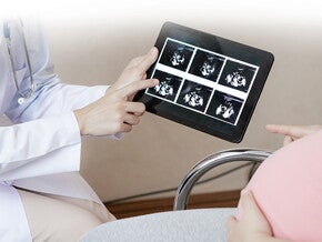 Mengenal 4 Jenis Pemeriksaan Kehamilan Mengenal 4 Jenis Pemeriksaan Kehamilan