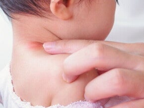 Tips dan Trik Mengatasi Ruam Kulit Alergi Pada Si Kecil Tips dan Trik Mengatasi Ruam Kulit Alergi Pada Si Kecil