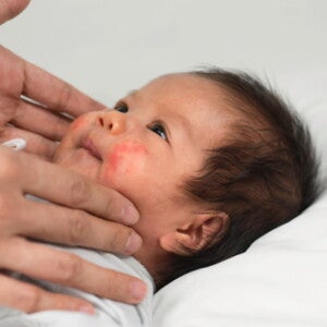 Penyebab Kulit Bayi Merah dan Cara Mengatasinya Penyebab Kulit Bayi Merah dan Cara Mengatasinya